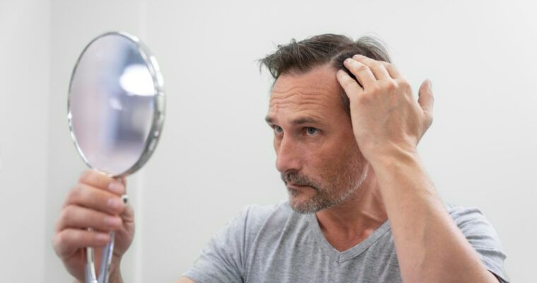 Soluciones para la alopecia en Madrid: Descubre los tratamientos capilares más avanzados
