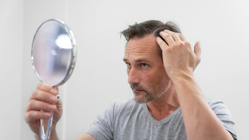 Soluciones para la alopecia en Madrid: Descubre los tratamientos capilares más avanzados